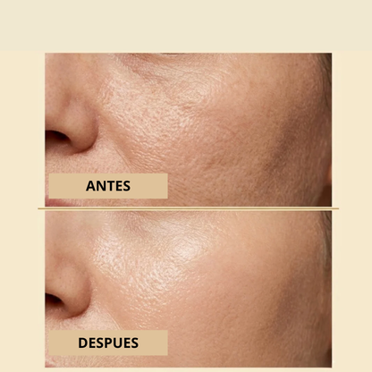 CollagenLift Pro™ – Efecto Lifting con Péptidos de Seda