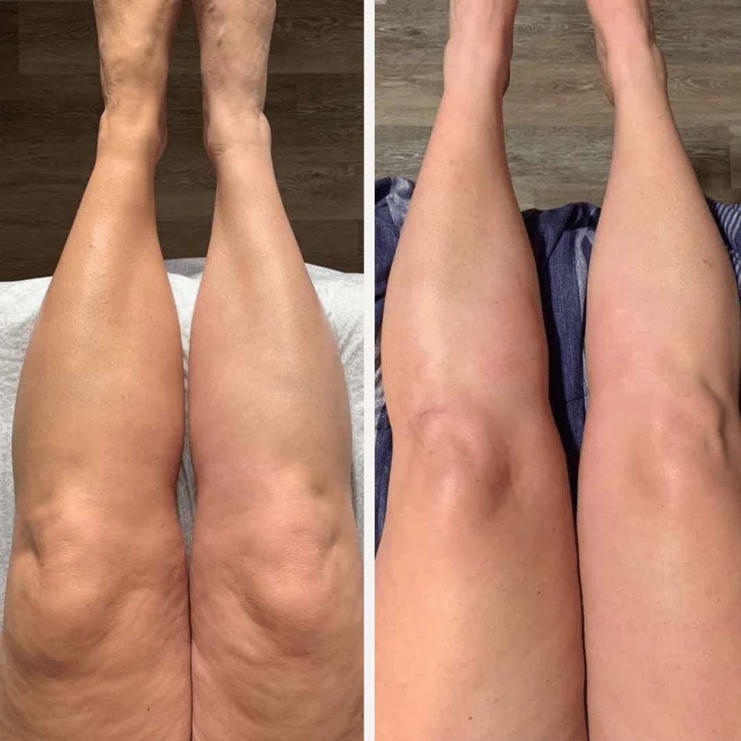 AceiteSlim Pro – Aceite Reductor Anticelulítico con Colágeno y Células Madre